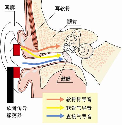 软骨传导的机理