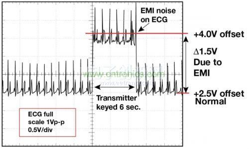 1.5 英尺以外的发射器（f = 470 MHz, P= 0.5W）开启和关闭时ECG 诊断设备的心脏检查结果