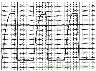 图3：IGBT输出信号