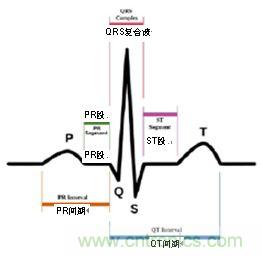 心电图中的 P-QRS-T波