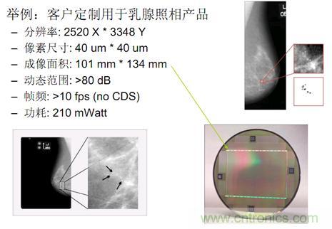  医学X光成像