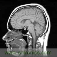 mri