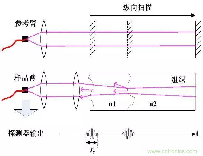 解读光学相干层析成像技术