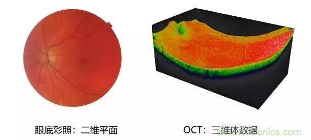 国际巨头布局全球眼科AI，中国智造能否打破OCT市场被外商垄断局面？