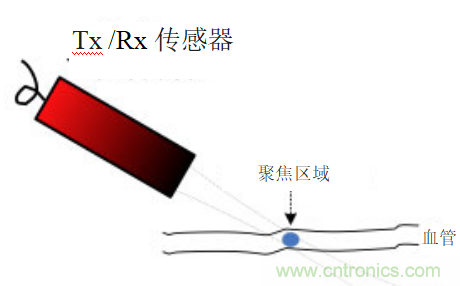 超声系统的信号链设计注意事项