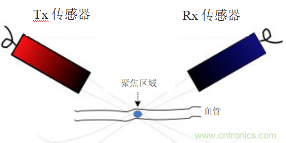 超声系统的信号链设计注意事项