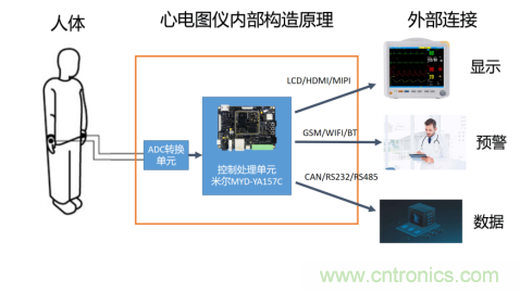 米尔基于STM32MP1的心电仪问市，助力全球医疗设施建设