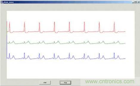 MSP430Ƶ12λĵ(ECG)Ŵ