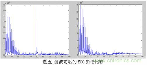 采用MSP430设计的12位心电(ECG)放大器 采用MSP430设计的12位心电(ECG)放大器