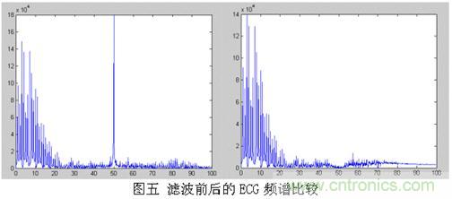 采用MSP430设计的12位心电(ECG)放大器