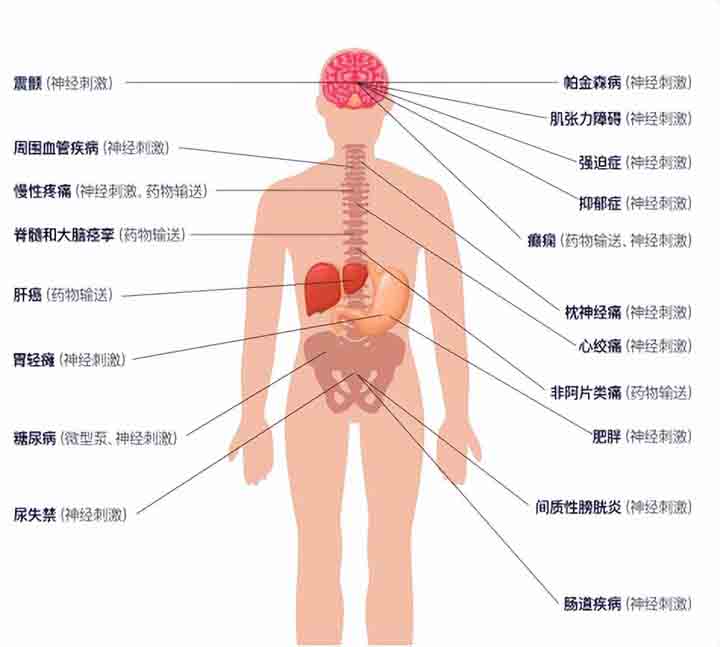 暖芯迦推出可编程神经调控平台芯片-元神ENS001